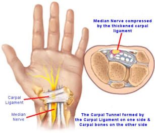 Anatomy of the Carpal Tunnel