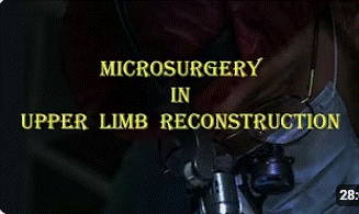 Microsurgery in Upper Limb Reconstruction